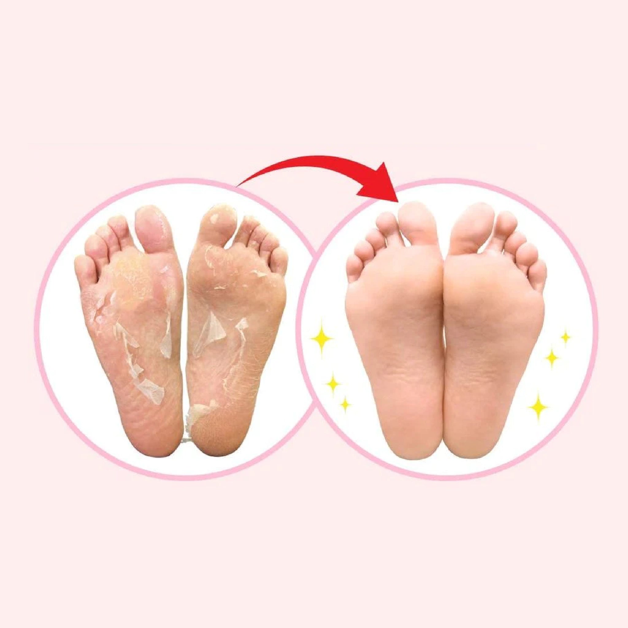 SOSU 去角质足膜 薰衣草 2对