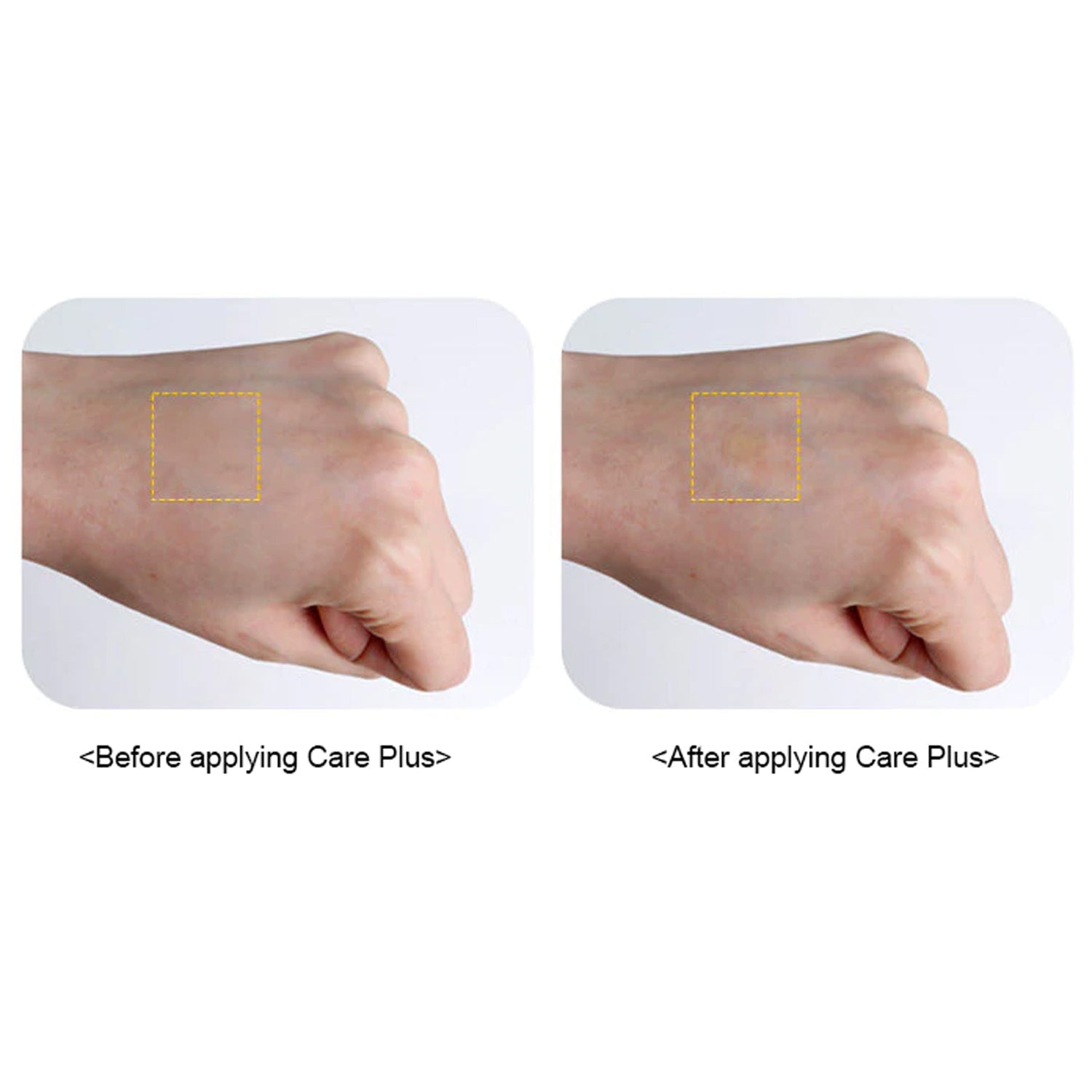 OLIVE YOUNG Care Plus Scar Cover Patch Kit